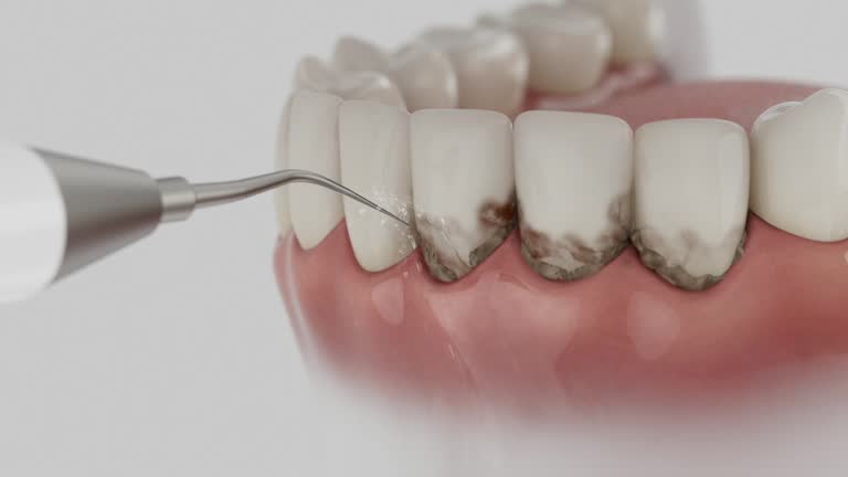 Trusted Invisalign Clear Aligners service in Ardmore, TN - Dentist Open Now